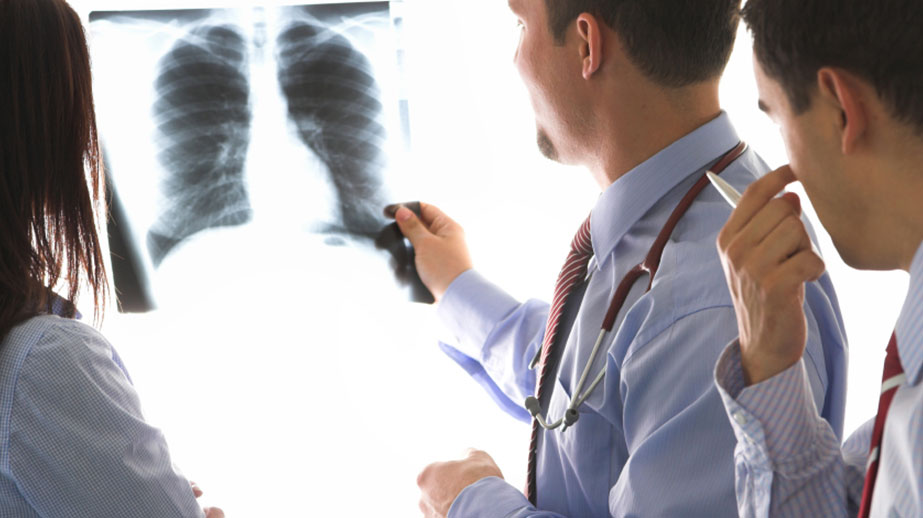 Doctors examining X-Ray of ribcage